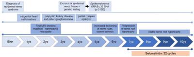 Case report: MEK inhibitor as treatment for multi-lineage mosaic KRAS G12D-associated epidermal nevus syndrome in a pediatric patient